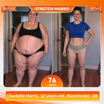 𝐎𝐟𝐟𝐢𝐜𝐢𝐚𝐥 𝐁𝐫𝐚𝐧𝐝 𝐒𝐭𝐨𝐫𝐞 🇬🇧| 𝐀𝐊𝐘𝐆𝐎® 𝟐𝟎𝟐𝟔 𝐌𝐨𝐫𝐢𝐧𝐠𝐚 x 𝐁𝐞𝐫𝐛𝐞𝐫𝐢𝐧𝐞 x 𝐍𝐀𝐃+ 𝟔-𝐈𝐧-𝟏 𝐌𝐢𝐜𝐫𝐨-𝐏𝐚𝐫𝐭𝐢𝐜𝐥𝐞 𝐒𝐜𝐮𝐥𝐩𝐭𝐢𝐧𝐠 & 𝐅𝐚𝐭-𝐁𝐮𝐫𝐧 𝐒𝐡𝐨𝐫𝐭𝐬 (Women + Men with Enhanced Male Vitality Blend💪)